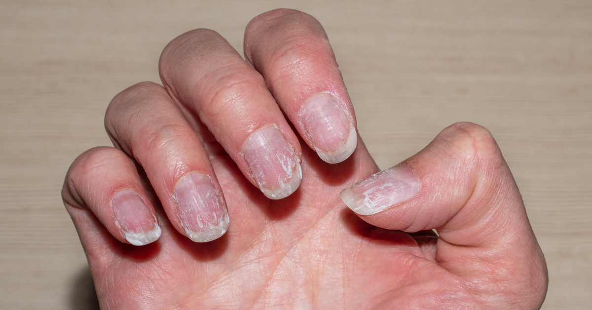 Manucure saine à la maison : comment obtenir des ongles beaux et durables sans compromis