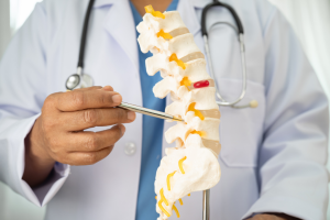 Thermocoagulation Témoignage : Retours de Patients sur l'Efficacité