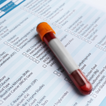 CPK Élevé et Fatigue